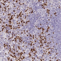 RCAN2 Antibody, Novus Biologicals 0.1mL; Unlabeled:Antibodies, Polyclonal